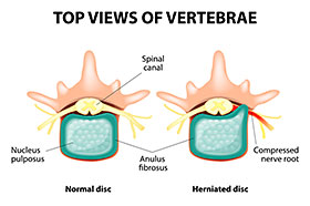 Chiropractic Southeast | Chiropractic Treatments